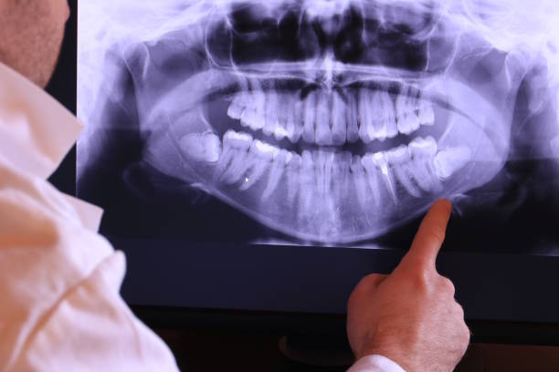 Best Emergency Denture Repair in Sonterra, TX